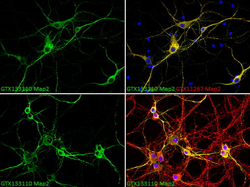 MAP2 antibody detects MAP2 protein in dendrites, but not in axons, by immunofluorescent analysis. Sample: DIV9 rat E18 primary cortical neurons were fixed in 4% paraformaldehyde at RT for 15 min. Grenn: MAP2 protein stained by MAP2 antibody (GTX133110) diluted at 1:500. Red (Top right): Dendrites, stained by MAP2 antibody [HM-2] (GTX11267) diluted at 1:1000. Red (Bottom right): Axons, stained by Tau antibody (GTX49353) diluted at 1:1000. Blue: Fluoroshield with DAPI (GTX30920).