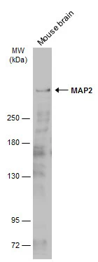 Mouse tissue extract (10 μg) was separated by 5% SDS-PAGE, and the membrane was blotted with MAP2 antibody (GTX133110) diluted at 1:1000. The HRP-conjugated anti-rabbit IgG antibody (GTX213110-01) was used to detect the primary antibody, and the signal was developed with Trident ECL plus-Enhanced. Mouse tissue extract (10 μg) was separated by 5% SDS-PAGE, and the membrane was blotted with MAP2 antibody (GTX133110) diluted at 1:1000. The HRP-conjugated anti-rabbit IgG antibody (GTX213110-01) was used to detect the primary antibody, and the signal was developed with Trident ECL plus-Enhanced.