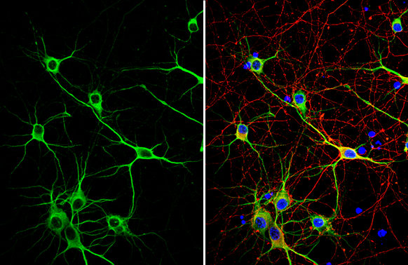 MAP2 antibody detects MAP2 protein in dendrites, but not in axons, by immunofluorescent analysis. Sample: DIV10 rat E18 primary cortical neuron cells were fixed in 4% paraformaldehyde at RT for 15 min. Green: MAP2 stained by MAP2 antibody (GTX133110) diluted at 1:500. Red: Tau, stained by Tau antibody [GT287] (GTX634809) diluted at 1:500. Blue: Fluoroshield with DAPI (GTX30920).