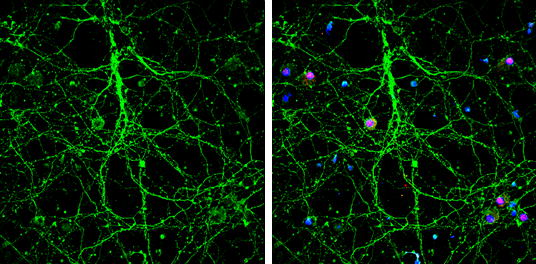 Nestin antibody