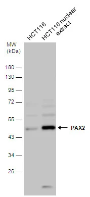 PAX2 antibody