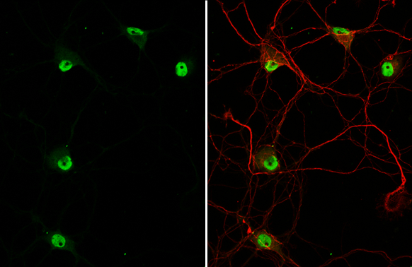 NeuN antibody detects NeuN protein at nucleus by immunofluorescent analysis. Sample: DIV9 rat E18 primary hippocampal neuron cells were fixed in 4% paraformaldehyde at RT for 15 min. Green: NeuN stained by NeuN antibody (GTX133127) diluted at 1:250. Red: Tau, an axon marker, stained by Tau antibody [GT287] (GTX634809) diluted at 1:500.