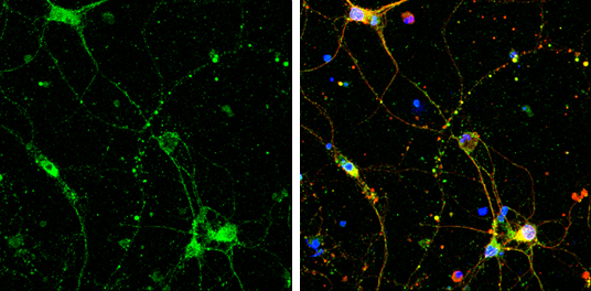 SHANK3 antibody