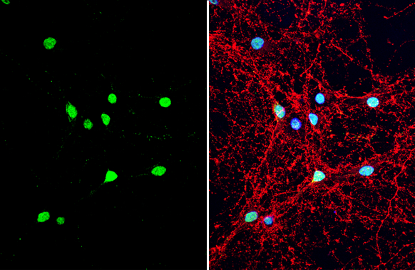 Anti-Neuropeptide Y antibody (GTX133138) | GeneTex
