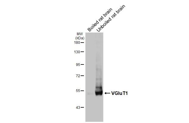Anti-VGluT1 antibody (GTX133148) | GeneTex