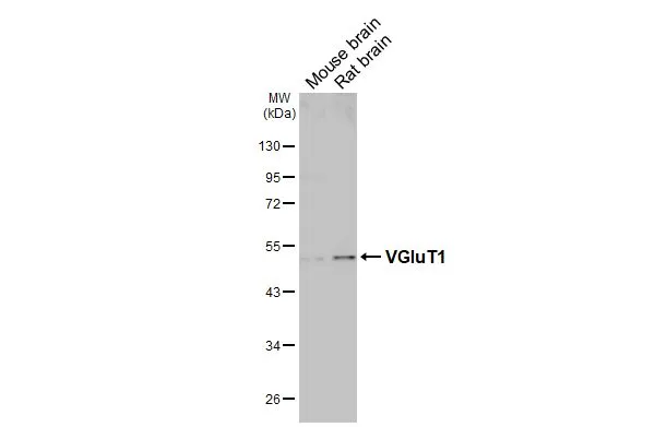Anti-VGluT1 antibody (GTX133148) | GeneTex