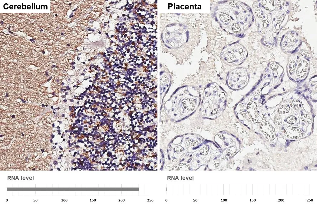 Anti-VGluT1 antibody (GTX133148) | GeneTex