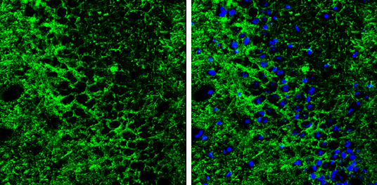 Anti-GABA Transporter 1 / GAT1 antibody (GTX133150) | GeneTex