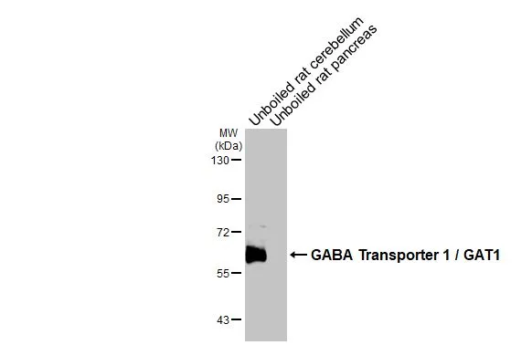 Anti-GABA Transporter 1 / GAT1 antibody (GTX133150) | GeneTex