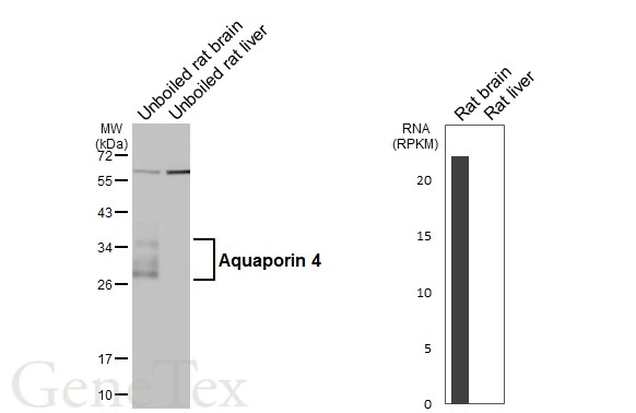 Anti-Aquaporin 4 antibody (GTX133151) | GeneTex