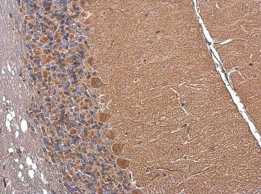 Somatostatin antibody