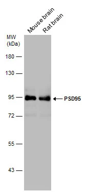 Various tissue extracts (50 μg) were separated by 7.5% SDS-PAGE, and the membrane was blotted with PSD95 antibody (GTX133167) diluted at 1:3000.