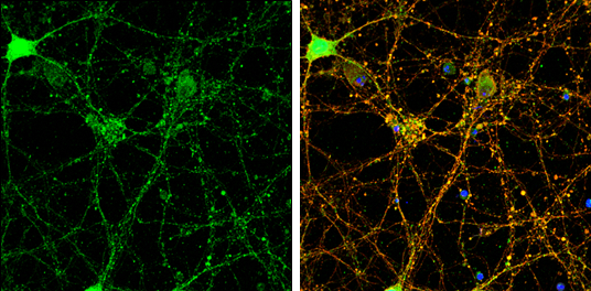 PSD95 antibody detects PSD95 protein by immunofluorescent analysis. Sample: DIV14 rat E18 primary cortical neurons were fixed in 4% paraformaldehyde at RT for 15 min. Green: PSD95 protein stained by PSD95 antibody (GTX133167) diluted at 1:500. Red: beta Tubulin 3/ Tuj1, stained by beta Tubulin 3/ Tuj1 antibody [GT1338] (GTX631831) diluted at 1:500. Blue: Fluoroshield with DAPI (GTX30920).