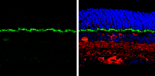 PSD95 antibody detects PSD95 protein by immunohistochemical analysis. Samples: Paraffin-embedded mouse retina. Green: PSD95 protein stained by PSD95 antibody (GTX133167) diluted at 1:250. Red: beta Tubulin 3/ Tuj1, a marker, stained by beta Tubulin 3/ Tuj1 antibody [GT1338] (GTX631831) diluted at 1:500. Blue: Fluoroshield with DAPI (GTX30920). 
 Antigen Retrieval: Citrate buffer, pH 6.0, 15 min