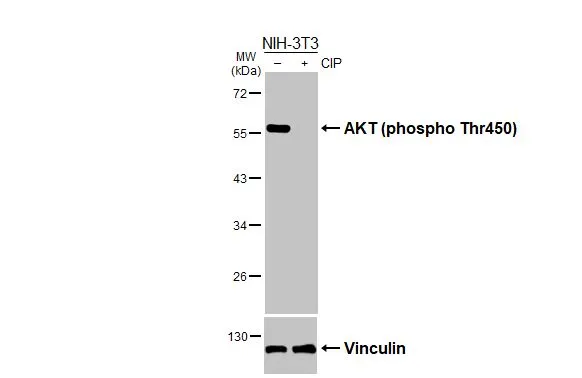 Untreated (–) and treated (+) NIH-3T3 whole cell extracts (30 μg) were separated by 10% SDS-PAGE, and the membrane was blotted with AKT (phospho Thr450) antibody (GTX133175) diluted at 1:500. The HRP-conjugated anti-rabbit IgG antibody (GTX213110-01) was used to detect the primary antibody.