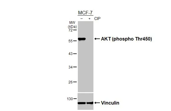 Untreated (–) and treated (+) MCF-7 whole cell extracts (30 μg) were separated by 10% SDS-PAGE, and the membrane was blotted with AKT (phospho Thr450) antibody (GTX133175) diluted at 1:1000. The HRP-conjugated anti-rabbit IgG antibody (GTX213110-01) was used to detect the primary antibody.