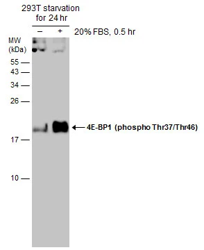 Untreated (–) and treated (+) 293T whole cell extracts (30 μg) were separated by 15% SDS-PAGE, and the membrane was blotted with 4E-BP1 (phospho Thr37/Thr46) antibody (GTX133181) diluted at 1:1000. Untreated (–) and treated (+) 293T whole cell extracts (30 μg) were separated by 15% SDS-PAGE, and the membrane was blotted with 4E-BP1 (phospho Thr37/Thr46) antibody (GTX133181) diluted at 1:1000.