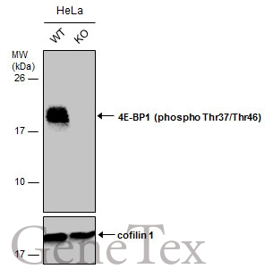 Wild-type (WT) and 4E-BP1 (phospho Thr37/Thr46) knockout (KO) HeLa cell extracts (30 μg) were separated by 15% SDS-PAGE, and the membrane was blotted with 4E-BP1 (phospho Thr37/Thr46) antibody (GTX133181) diluted at 1:500. The HRP-conjugated anti-rabbit IgG antibody (GTX213110-01) was used to detect the primary antibody. Wild-type (WT) and 4E-BP1 (phospho Thr37/Thr46) knockout (KO) HeLa cell extracts (30 μg) were separated by 15% SDS-PAGE, and the membrane was blotted with 4E-BP1 (phospho Thr37/Thr46) antibody (GTX133181) diluted at 1:500. The HRP-conjugated anti-rabbit IgG antibody (GTX213110-01) was used to detect the primary antibody.