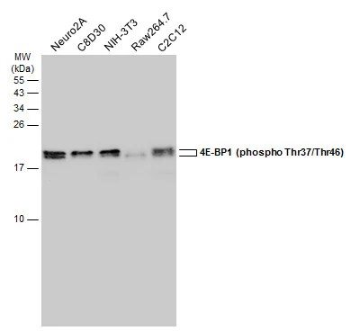 Various whole cell extracts (30 μg) were separated by 15% SDS-PAGE, and the membrane was blotted with 4E-BP1 (phospho Thr37/Thr46) antibody (GTX133181) diluted at 1:5000. The HRP-conjugated anti-rabbit IgG antibody (GTX213110-01) was used to detect the primary antibody. Various whole cell extracts (30 μg) were separated by 15% SDS-PAGE, and the membrane was blotted with 4E-BP1 (phospho Thr37/Thr46) antibody (GTX133181) diluted at 1:5000. The HRP-conjugated anti-rabbit IgG antibody (GTX213110-01) was used to detect the primary antibody.