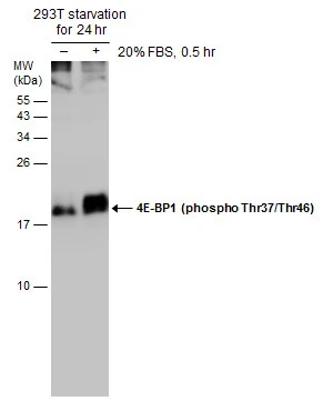 Untreated (–) and treated (+) 293T whole cell extracts (30 μg) were separated by 15% SDS-PAGE, and the membrane was blotted with 4E-BP1 (phospho Thr37/Thr46) antibody (GTX133182) diluted at 1:1000.