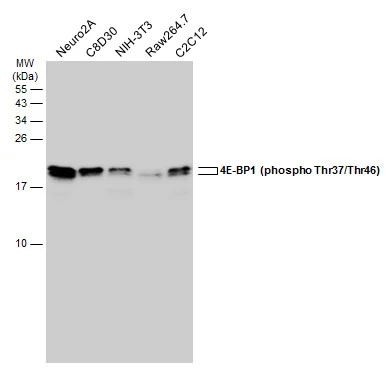 Various whole cell extracts (30 μg) were separated by 15% SDS-PAGE, and the membrane was blotted with 4E-BP1 (phospho Thr37/Thr46) antibody (GTX133182) diluted at 1:5000. The HRP-conjugated anti-rabbit IgG antibody (GTX213110-01) was used to detect the primary antibody.