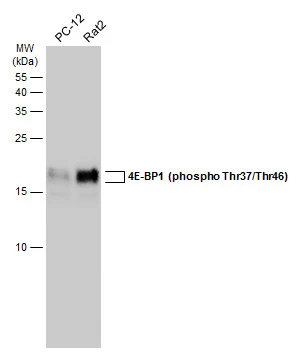 Various whole cell extracts (30 μg) were separated by 15% SDS-PAGE, and the membrane was blotted with 4E-BP1 (phospho Thr37/Thr46) antibody (GTX133182) diluted at 1:5000. The HRP-conjugated anti-rabbit IgG antibody (GTX213110-01) was used to detect the primary antibody.