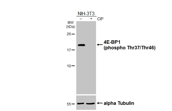Untreated (–) and treated (+) NIH-3T3 whole cell extract (30 μg) were separated by 15% SDS-PAGE, and the membrane was blotted with 4E-BP1 (phospho Thr37/Thr46) antibody (GTX133182) diluted at 1:5000. The HRP-conjugated anti-rabbit IgG antibody (GTX213110-01) was used to detect the primary antibody.