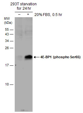 Untreated (–) and treated (+) 293T whole cell extracts (60 μg) were separated by 15% SDS-PAGE, and the membrane was blotted with 4E-BP1 (phospho Ser65) antibody (GTX133184) diluted at 1:500.
