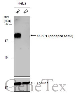 Wild-type (WT) and 4E-BP1 (phospho Ser65) knockout (KO) HeLa cell extracts (30 μg) were separated by 15% SDS-PAGE, and the membrane was blotted with 4E-BP1 (phospho Ser65) antibody (GTX133184) diluted at 1:500. The HRP-conjugated anti-rabbit IgG antibody (GTX213110-01) was used to detect the primary antibody, and the signal was developed with Trident ECL plus-Enhanced. Wild-type (WT) and 4E-BP1 (phospho Ser65) knockout (KO) HeLa cell extracts (30 μg) were separated by 15% SDS-PAGE, and the membrane was blotted with 4E-BP1 (phospho Ser65) antibody (GTX133184) diluted at 1:500. The HRP-conjugated anti-rabbit IgG antibody (GTX213110-01) was used to detect the primary antibody, and the signal was developed with Trident ECL plus-Enhanced.