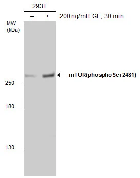 Untreated (–) and treated (+) 293T whole cell extracts (60 μg) were separated by 5% SDS-PAGE, and the membrane was blotted with mTOR(phospho Ser2481) antibody (GTX133190) diluted at 1:1000.