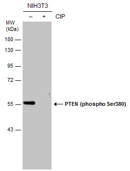 Untreated (–) and treated (+) NIH3T3 whole cell extracts (60 μg) were separated by 10% SDS-PAGE, and the membrane was blotted with PTEN (phospho Ser380) antibody (GTX133192) diluted at 1:1000.
