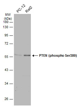 Various whole cell extracts (30 μg) were separated by 10% SDS-PAGE, and the membrane was blotted with PTEN (phospho Ser380) antibody (GTX133192) diluted at 1:500. The HRP-conjugated anti-rabbit IgG antibody (GTX213110-01) was used to detect the primary antibody.
