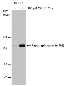Untreated (–) and treated (+) MCF-7 whole cell extracts (60 μg) were separated by 7.5% SDS-PAGE, and the membrane was blotted with Raptor (phospho Ser792) antibody (GTX133196) diluted at 1:1000.
