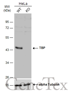 Wild-type (WT) and TBP knockout (KO) HeLa cell extracts (30 μg) were separated by 10% SDS-PAGE, and the membrane was blotted with TBP antibody (GTX133204) diluted at 1:2000. The HRP-conjugated anti-rabbit IgG antibody (GTX213110-01) was used to detect the primary antibody.