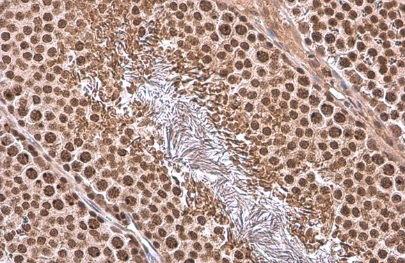TBP antibody detects TBP protein at nucleus by immunohistochemical analysis. Sample: Paraffin-embedded rat testis. TBP stained by TBP antibody (GTX133204) diluted at 1:500. Antigen Retrieval: Citrate buffer, pH 6.0, 15 min