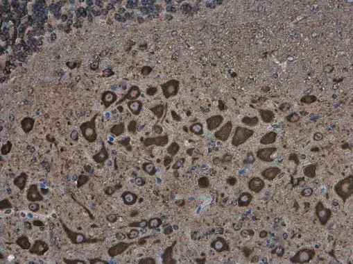 MAP1B antibody
