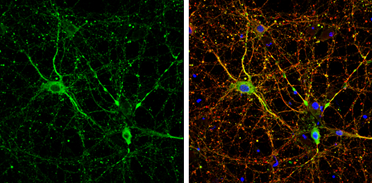 MAP1B antibody