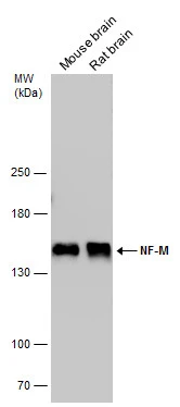 NF-M antibody