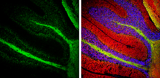 NF-M antibody