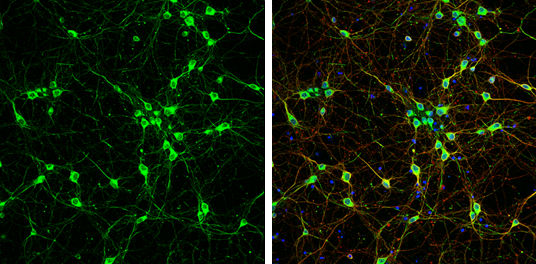 NF-M antibody