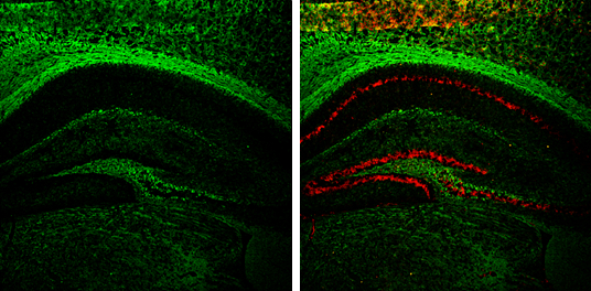 NF-M antibody