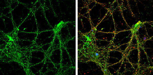 Reelin antibody
