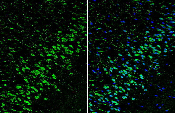 Reelin antibody