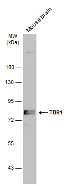 TBR1 antibody