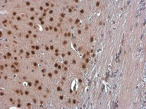 TBR1 antibody