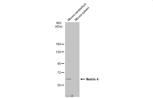Various tissue extracts (50 μg) were separated by 7.5% SDS-PAGE, and the membrane was blotted with Netrin 4 antibody (GTX133230) diluted at 1:1000. The HRP-conjugated anti-rabbit IgG antibody (GTX213110-01) was used to detect the primary antibody.