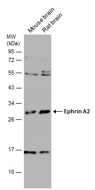 Ephrin A2 antibody