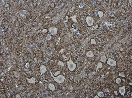 VAMP2 antibody