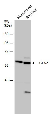 Various tissue extracts (75 μg) were separated by 10% SDS-PAGE, and the membrane was blotted with GLS2 antibody (GTX133242) diluted at 1:1000.