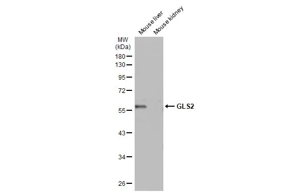 Various tissue extracts (50 μg) were separated by 10% SDS-PAGE, and the membrane was blotted with GLS2 antibody (GTX133242) diluted at 1:500. The HRP-conjugated anti-rabbit IgG antibody (GTX213110-01) was used to detect the primary antibody.